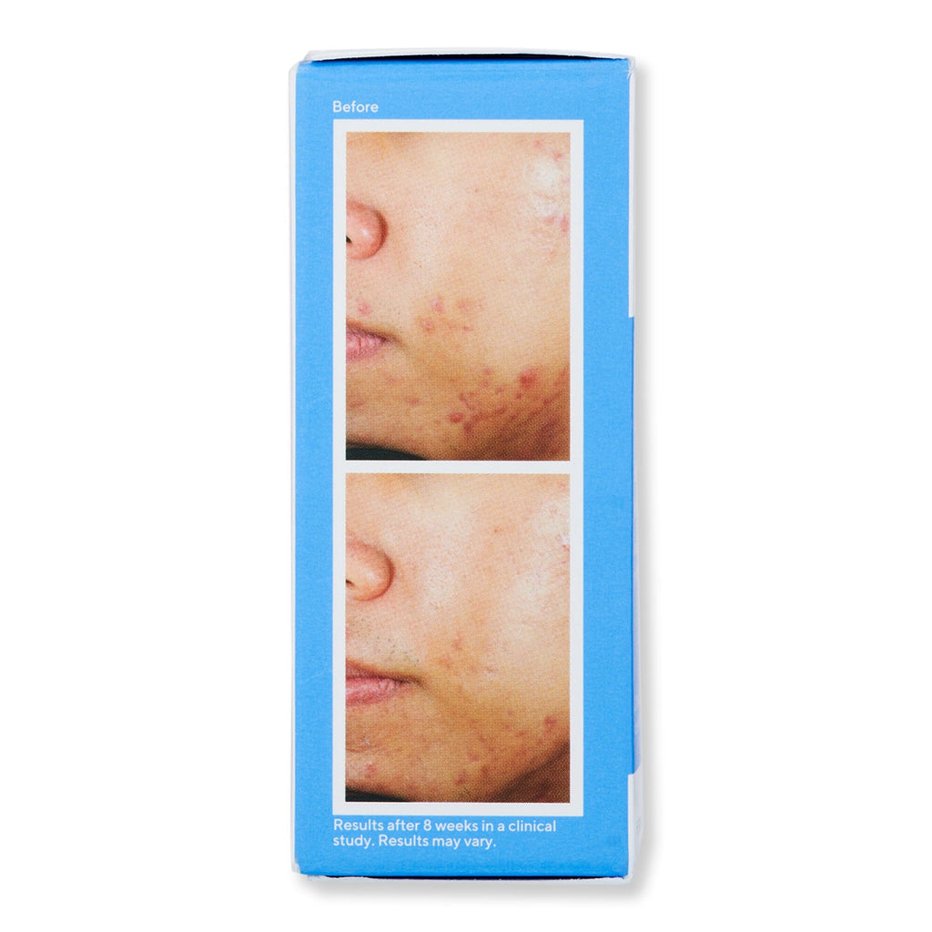 Murad Murad Deep Relief Acne Treatment Acne, Blemish, & Blackhead Treatments 