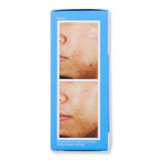 Murad Murad Deep Relief Acne Treatment Acne, Blemish, & Blackhead Treatments 